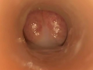 Cervix Kisses Cocks Cumming Inside Cumshot Compilation Hotporntv